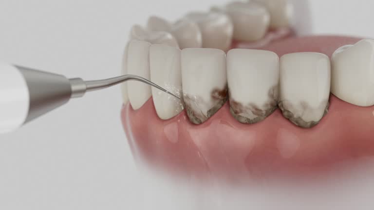Trusted Teeth Cleaning And Checkup service in Franklin, PA - Dentist Open Now